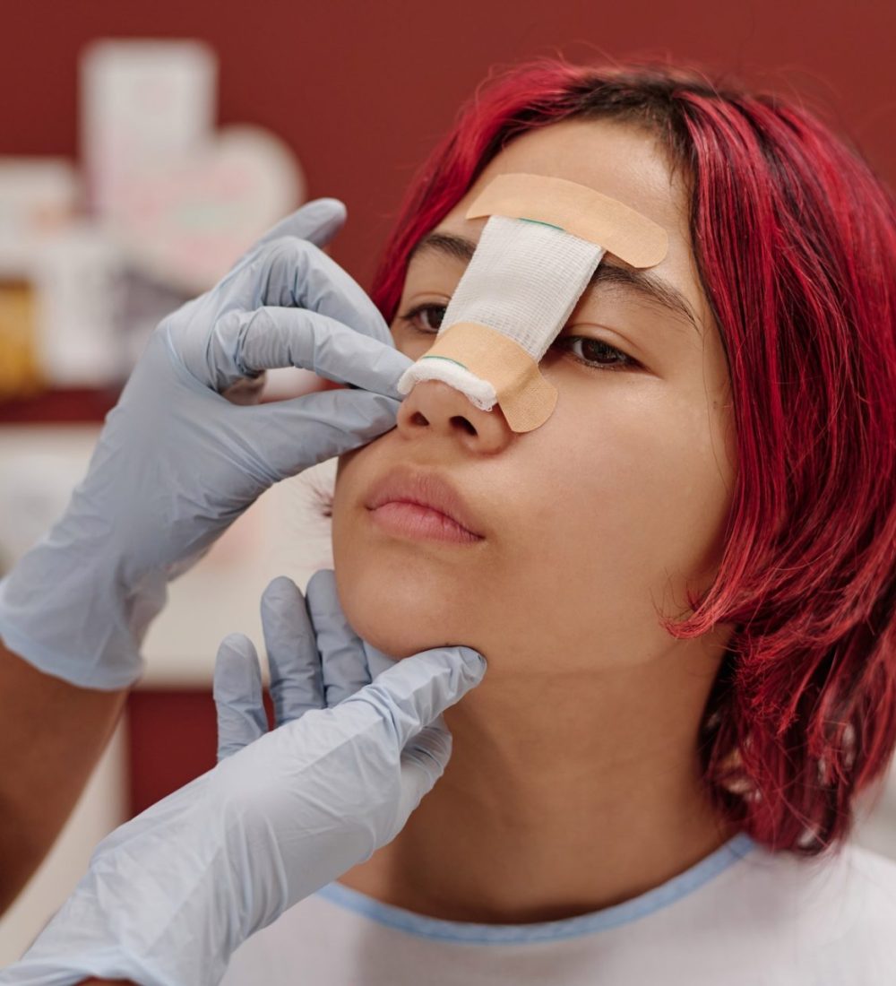 Casos de éxito Rinoplastia Casos de éxito Rinoplastia